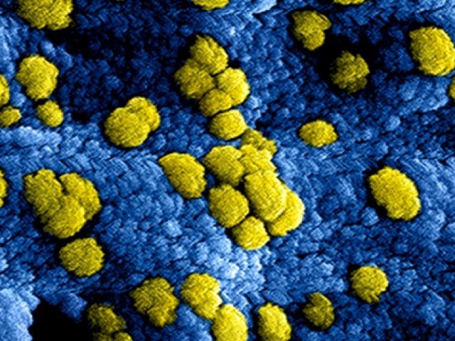 Corona bacteriën, geel en zwart ingezoomd, vierkant